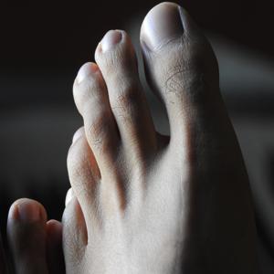 발 측면 통증의 원인과 치료 방법